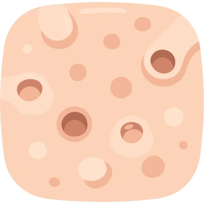 cisti pore benefit